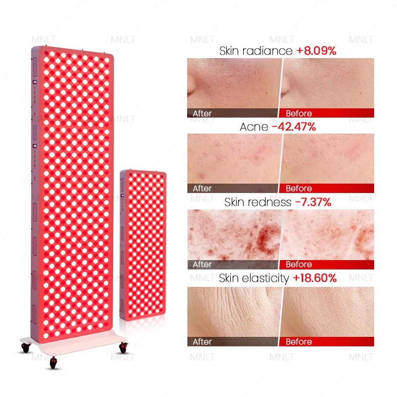 Red Light Therapy Panel: FDA-Cleared Full Body Wellness & Skin Rejuvenation
